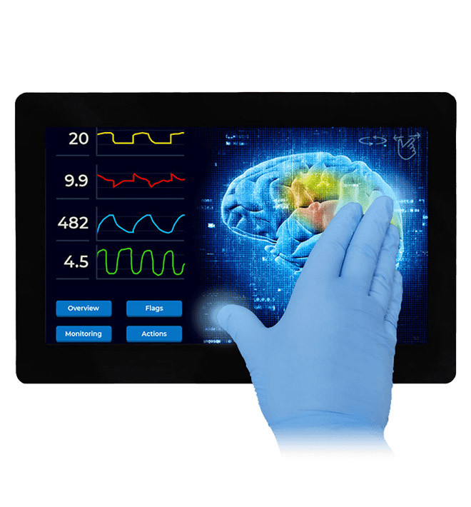 A solid and versatile HMI-solution for many years to come